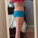 2 week post op side view (swollen above pubic area)