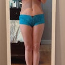 2 week post op front view with "cut impression"