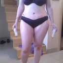 Day 4 Post Op!
