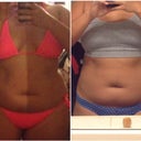Left is back in August about 4 weeks before procedure and the right side is 1 week post lower ab procedure. I can see a bit of a difference because my belly button doesn't look so sad on the right.