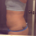 One week post lower ab