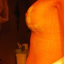 Day 2 post op.