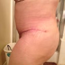 Other side...  More swollen than the right. 4wk 5days