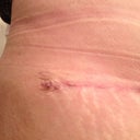 Right side where I thought may be a dog ear, but PS said he is confident that it will be fine.