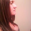 Rhinoplasty after