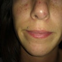 after front profile