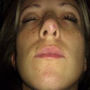 after under nostril view