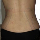 Day 3 - back view