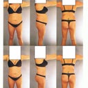 Top pics are before and bottom ones are the computer generated after pics.