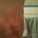 after day 2 very very swollen