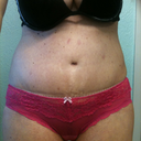 4Wk front