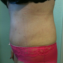 4Wk side