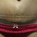 4wk incision