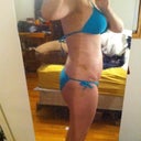 12 days post op side