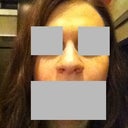 Before - Hate the round, wide, undefined tip and large nostrils