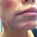 Close up of lips with no bruising