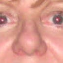 This is my before nose