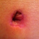 Up close of bb (scar is in pink stage)