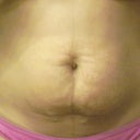 Close up of my squishy belly as my 3 year old would refer to it...lol