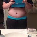 Thin scar :) I'm so happy! Tummy and Hips are still swollen