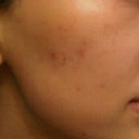 3 weeks after