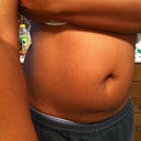 Before Surgery
