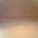 4 weeks PO - underside 2