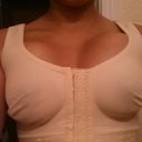 My Bra from doctor its a 36d. The nurse said as i drop i will fill it out more. I just hope they smaller than that. Left one been more swollen since surgery.