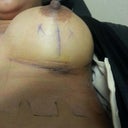 I love my scars barely there.