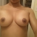 4 weeks. Of course the pic is reversed but my left one is higher and more swollen you can really tell.