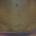 The scar 1 year