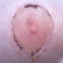 Day 20:  Right nipple.  You can see the red scabs from where the skin peeled off.  Looked freaky when it was glistening pink without the scab!  They're healing up though, and I do think they'll look fine when they're done healing.