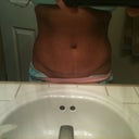 scar looking pretty good 7 weeks