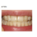 beforeandafter.png
