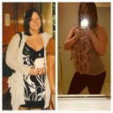 Before weight loss and after surgery