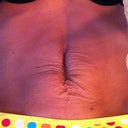 Laying down and flexing, skin sinks in between muscles.