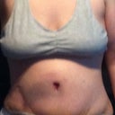this is sometime in the first or second week. Really swollen