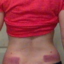 Here comes the bruising