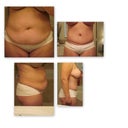 before and 2 months after