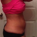 End of the day on day 5- swelling is worst at the end of everyday after being active... I did go to the gym today too!