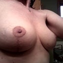 4 Weeks post op