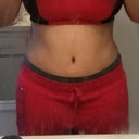 6 weeks post op