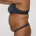 Pre-op- January 2013