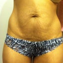 After three kids my tummy needs some help