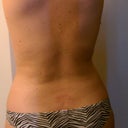 Back day 15
