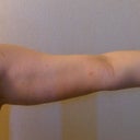 Arm
