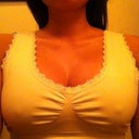 Week 5 losing the fake look upper pole fullness