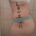 Post op