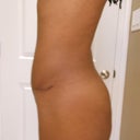 3 months, 1 day. Left side.