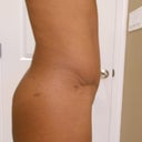 3 months, 1 day. Right side.